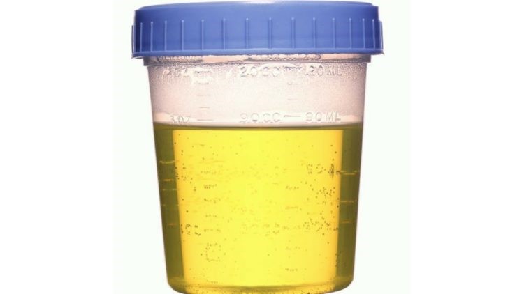 Synthetic Urine 
      Temperature Strips Glide Place Davis CA